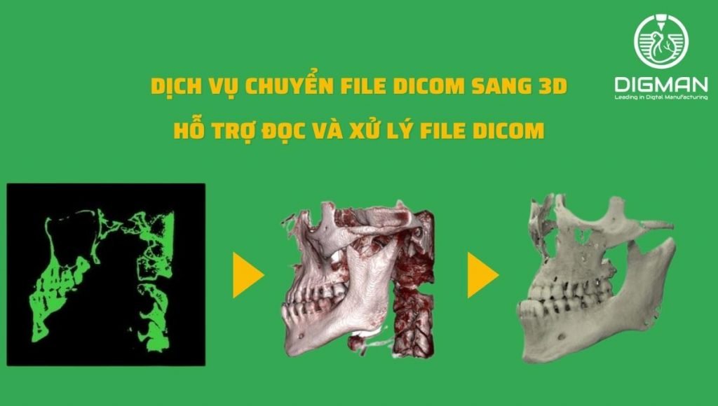 dicom là gì